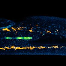 Fluorescent view of a zebrafish embryo