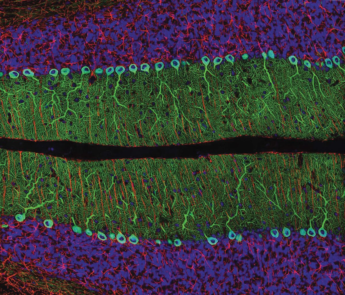Micrograph of a rat cerebellum