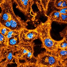 Microscopic view of monkey cells in orange and blue
