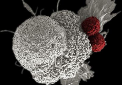 electron micrograph of grey cancer cell, with two red T cells stuck to the side