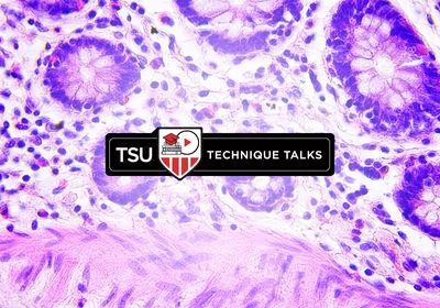 Technique Talk: Developing and Optimizing Immunohistochemistry Protocols