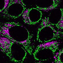 Fluorescence microscopy image of cells expressing fluorescent biosensors. Green and magenta fluorescence is observed outside of the cell nuclei.