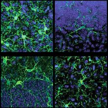 Panels showing different kinds of microglia