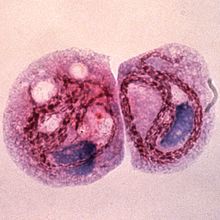 A microscope image of Legionellales bacteria infecting a protozoan