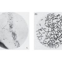 two black-and-white microscope images, one with a few black dots, the other with many rod-shaped bacteria