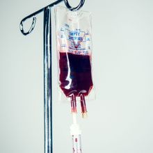 Human blood in a plastic Intravenous drip bag, the tube running out of the image. Square crop. Horizontal with copy space.