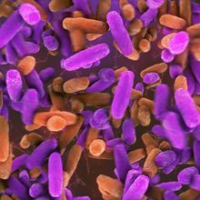 Bright purple and orange lactobacillus bacteria.