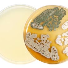 Two agar plates superimposed on each other. One is empty while the other is growing multiple different cultured organisms, colored white, beige, and green.