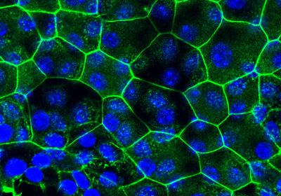 Bladder epithelial tissue, where cell junctions are shown in green and nuclei in blue. This was grown in vitro from cells taken from mice with chronic cystitis.