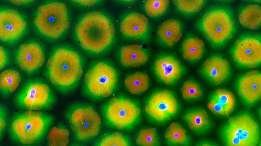 A nearly homogeneous field of yellow cytoplasm spontaneously compartmentalizes itself into clumps around the dots of nuclei.