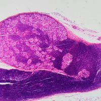 a pink and purple micrograph of a longitudinal section of human spinal ganglion cells