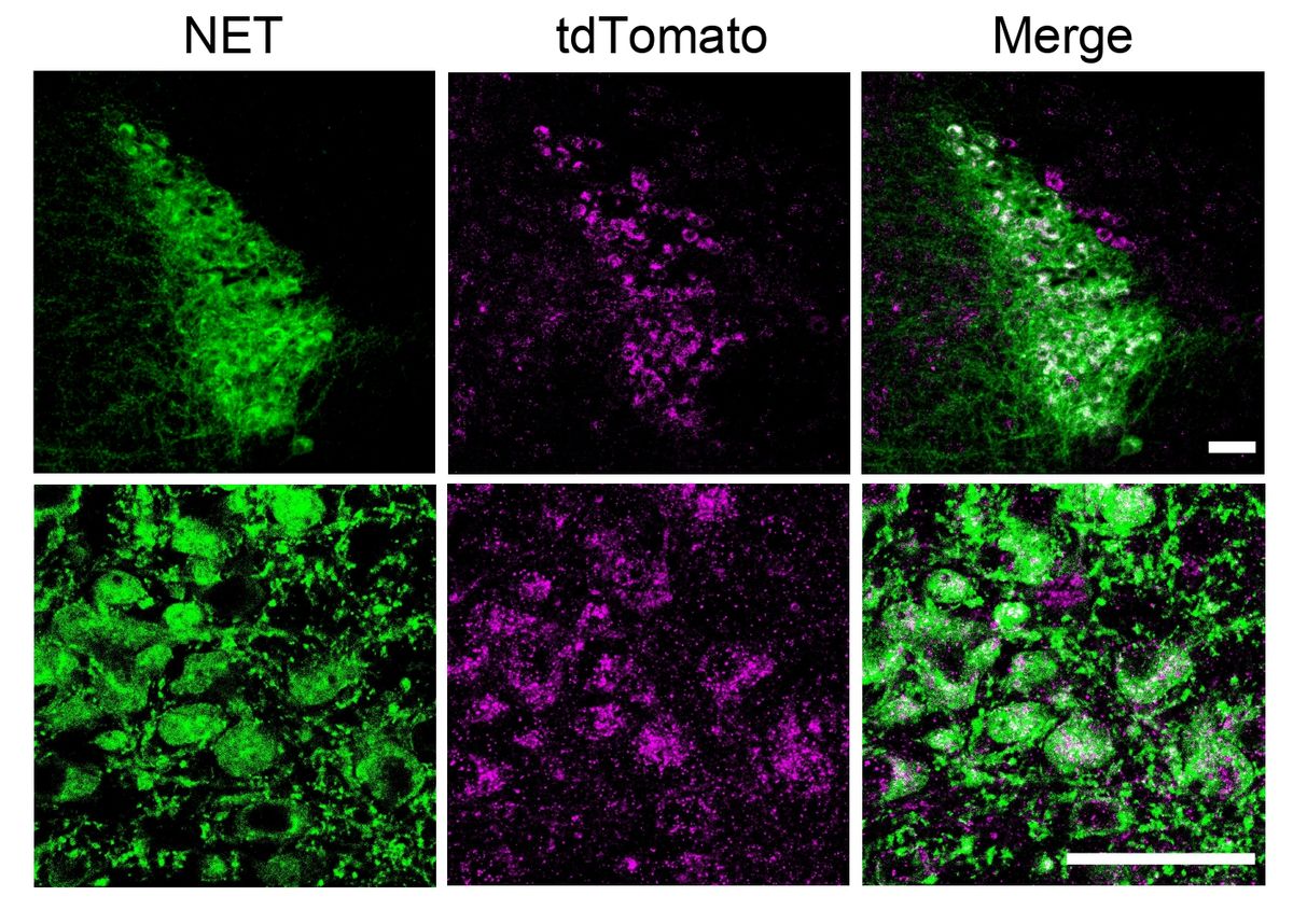 Panel where the hormone FGF21 coreceptor is shown in magenta (center) and the locus coeruleus is shown in green (left). The two images merged (right) show the subpopulation of noradrenergic neurons—in white—where the hormone acts.
