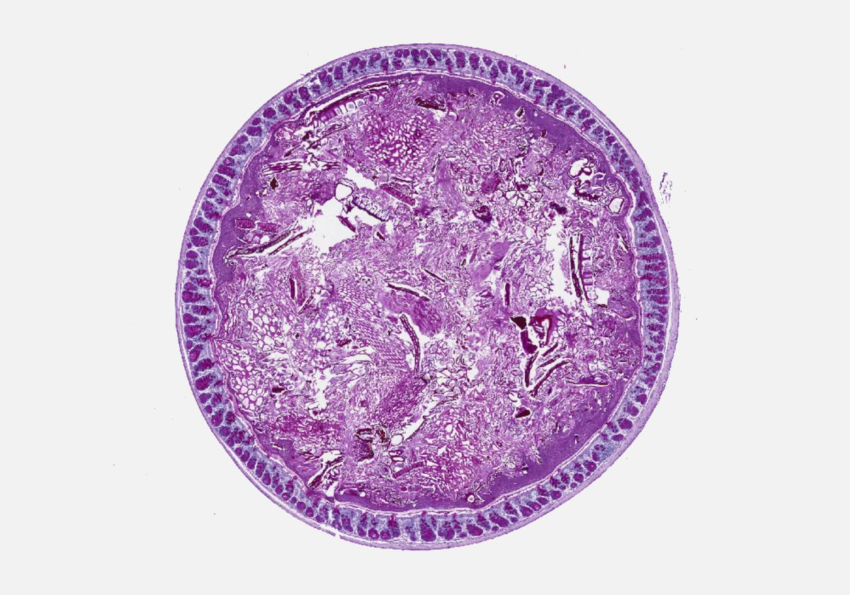a violet stained section of the colonic mucus layer.