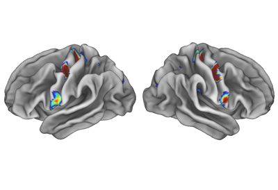 fMRI scan of two brains