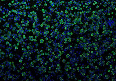 Image shows photorhabdus virulence cassettes (green) binding to insect cells (blue) prior to injection of payload proteins.&nbsp;