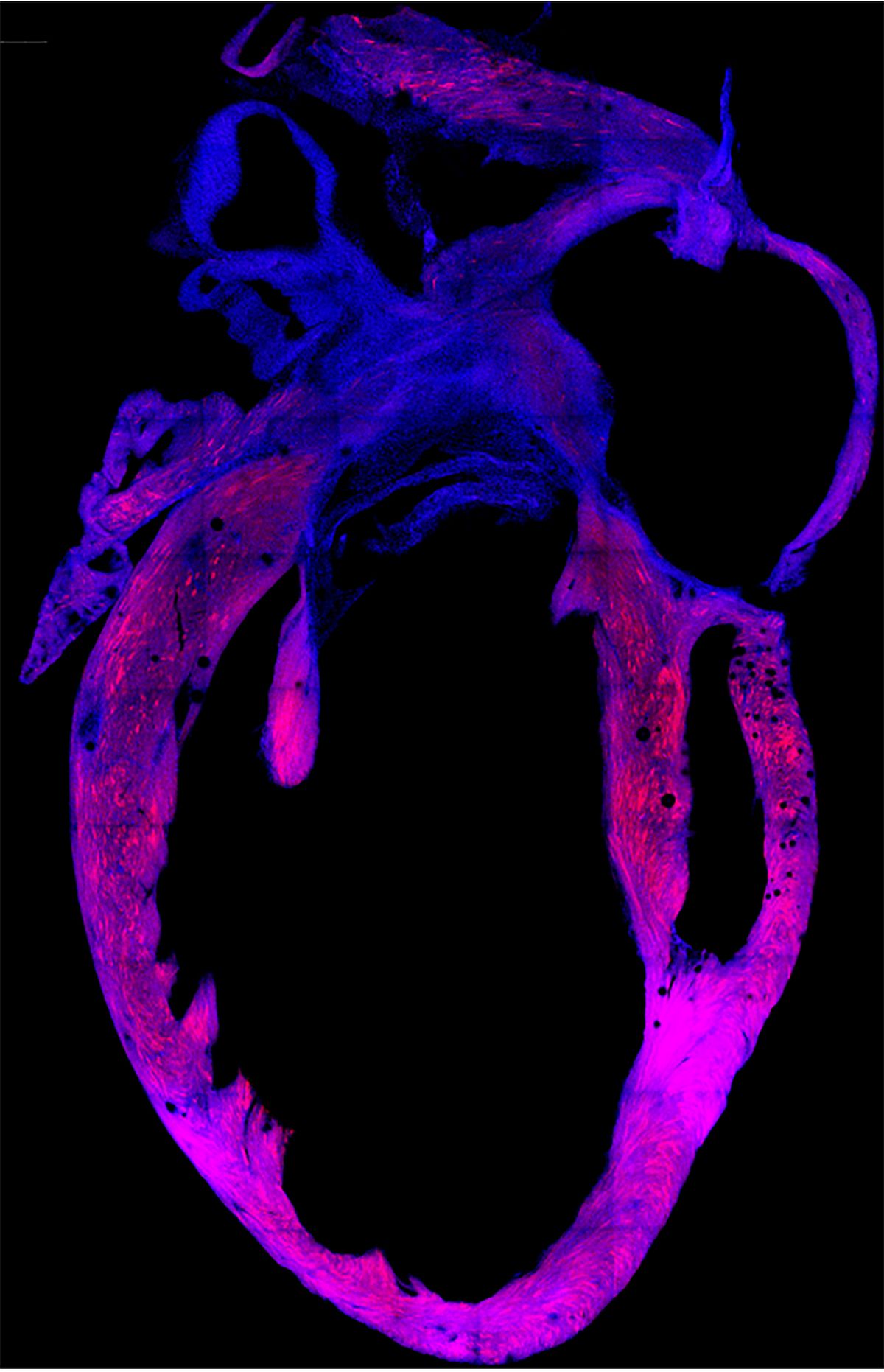 Purple and blue fluorescent image of heart
