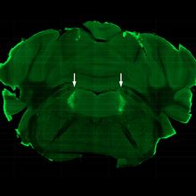 A cross-section of mouse brain showing the locus coeruleus in fluorescent green