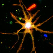 two glowing neuronlike macrophages