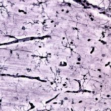 Microglia stained black