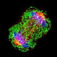 A colored microscopy image of a dividing breast cancer cell