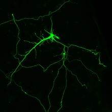 a human neuron illuminated in bright green on a black background.