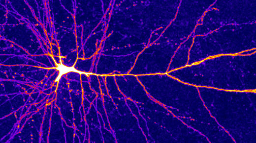 Micrograph of a cortical neuron, showing its many dendrites.