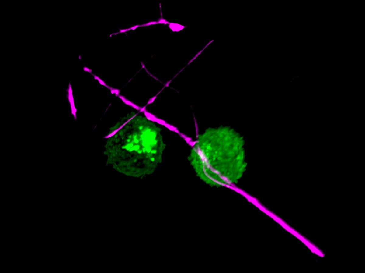 Microscopy image showing two dendritic cells (green) communicating with a nociceptor neuron (violet).