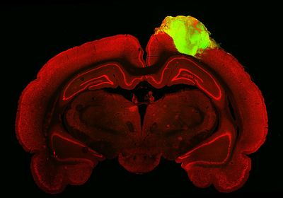 an image of a slice of a rat brain is colored red on a black background. a lime green human organoid sits in the top left of the brain