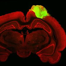 an image of a slice of a rat brain is colored red on a black background. a lime green human organoid sits in the top left of the brain