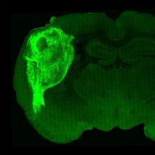a section of a rat brain is imaged in dull green. a much brighter green human organoid takes up a large portion of the left side of the brain.