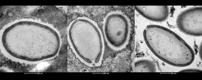 The giant virus Pandoravirus neocaledonia inside the amoeba Acanthamoeba castellanii.