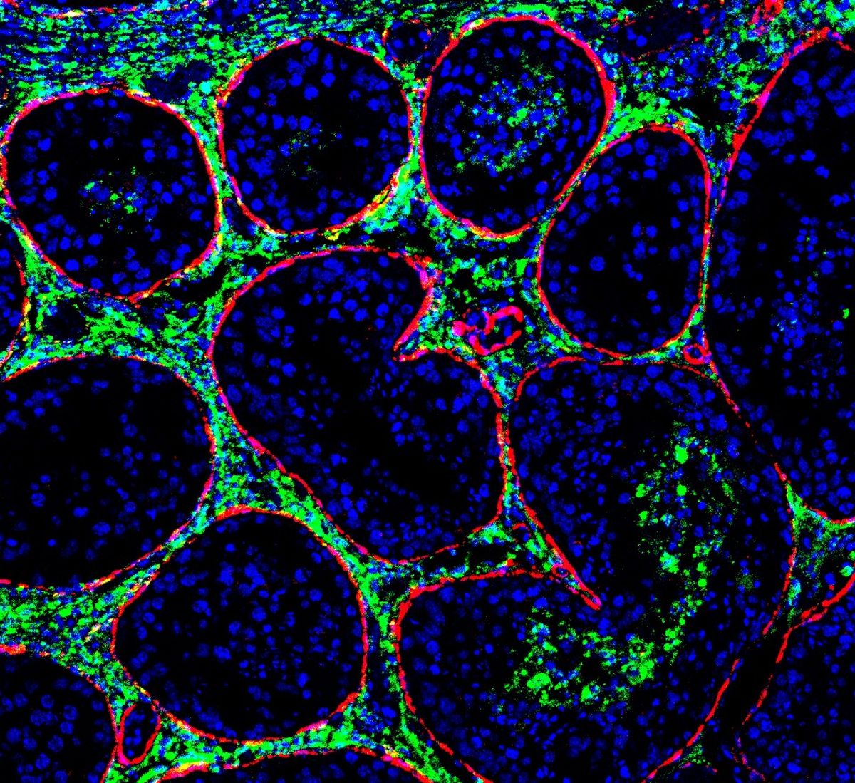 Immunofluorescence staining demonstrates that monkeypox virus (green) can be detected in the somniferous tubules (red), the sites of sperm maturation and storage, of a crab-eating macaque with acute monkeypox infection.