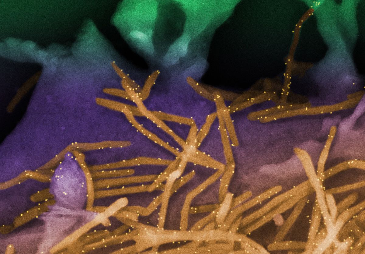 Colorized SEM image of RSV virions highlighting RSV F proteins