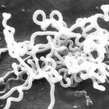 A cluster of spiral-shaped Treponema pallidum bacteria, the causative agent of syphilis.