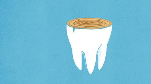 Illustration: sliced tooth showing tree rings