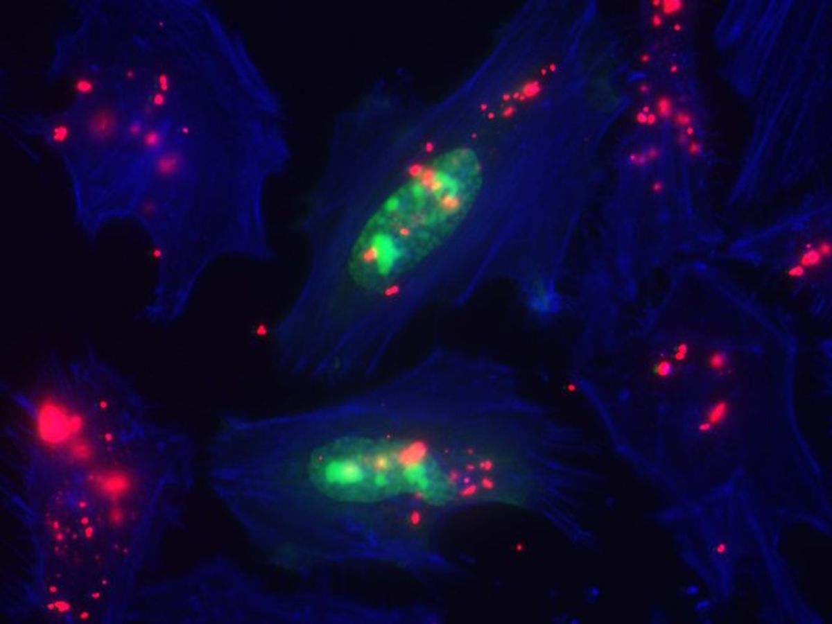 Fluorescent microscopy images of cells after being transfected.