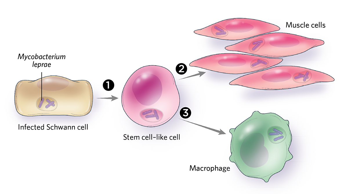Illustration showing how mycobacterium leprae, which causes leprosy, takes cell reprogramming to an extreme by reverting its Schwann cell host into a stem cell–like state