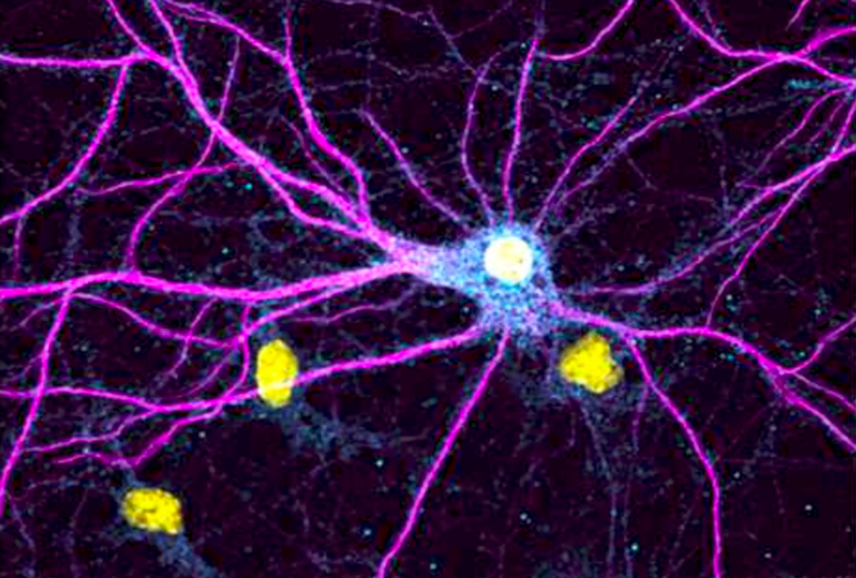 A neuron with a blue haze around its central body