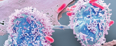 Bacteria as Living Microrobots to Fight Cancer