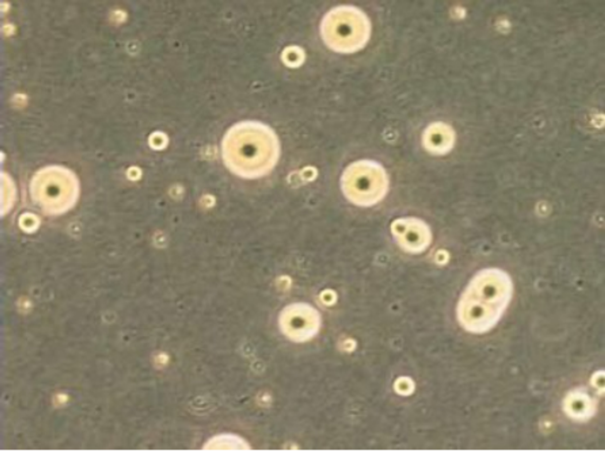 Light microscope image of mycoplasma colonies