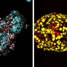 A normal human liver organoid (left) stained with blue and red next to a fatty liver organoid (right) with lipid droplets stained yellow.