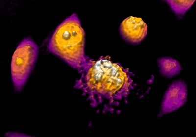 Visualizing apoptosis in a DU-145 cancer cell