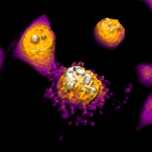 Visualizing apoptosis in a DU-145 cancer cell