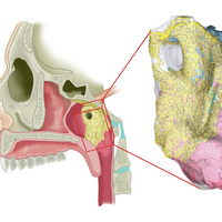 salivary gland new human anatomy head and neck cancer radiation therapy